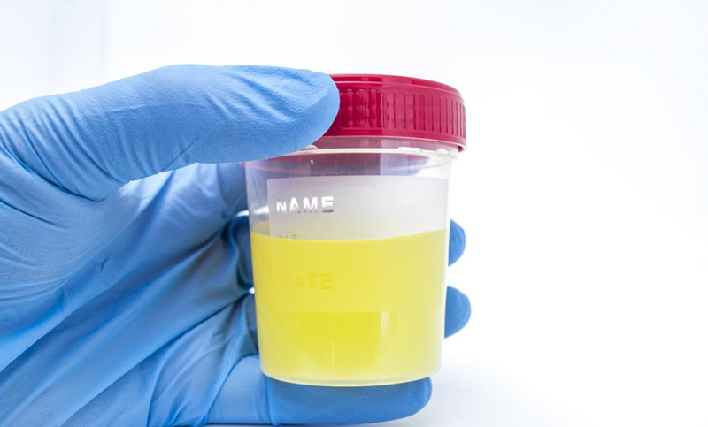 uti cloudy urine