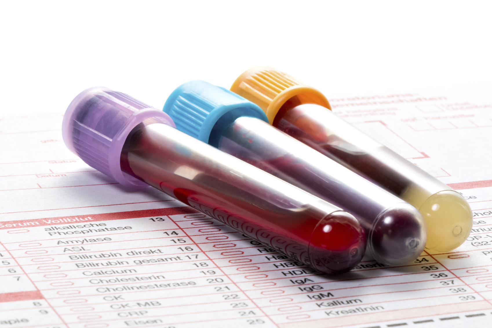 blood tetes - Understanding Calcium Blood Tests: Importance, Procedure, and What Your Results Mean