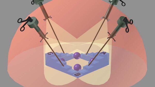 what is laparoscopy