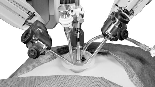 robotic cysectomy