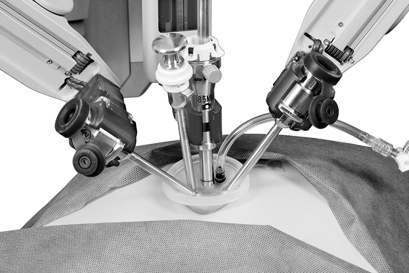 An Overview of Robotic Cystectomy | Urology Specialist