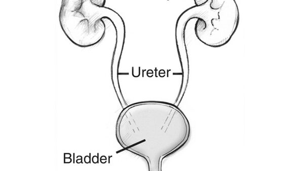 blood in the urine