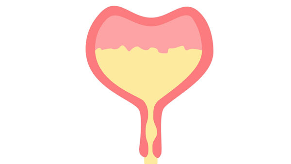 Overactive bladder