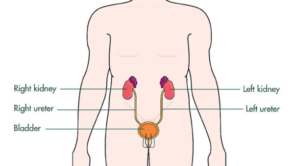 Urinary catheter