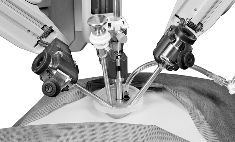 Urinary Diversion