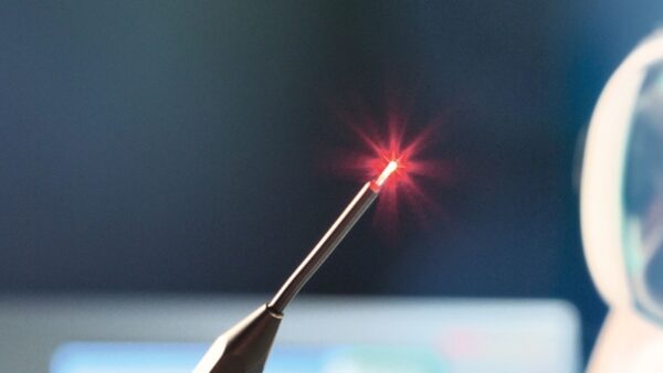 laser
