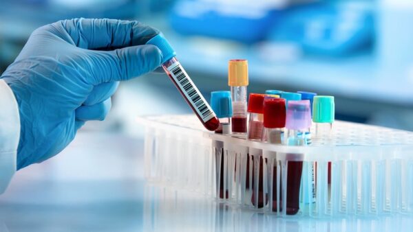 calcium blood test