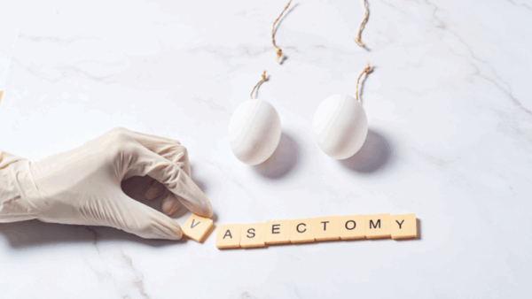 vasectomy