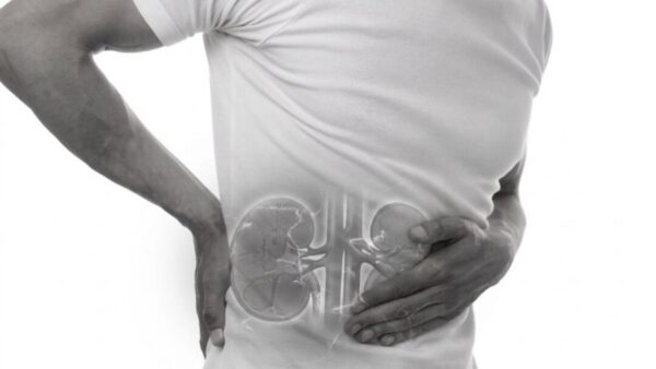 Radical nephrectomy sydney