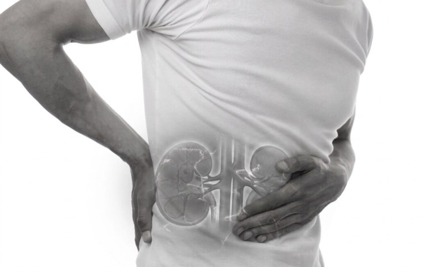Radical nephrectomy sydney